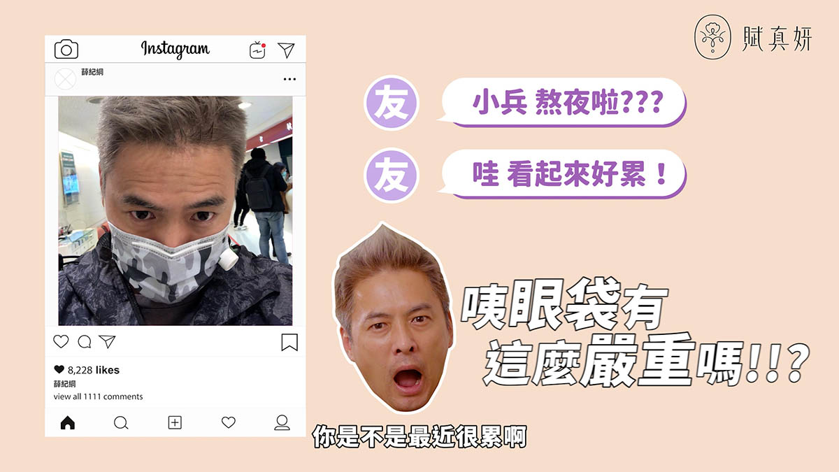 賦真妍眼袋手術 2