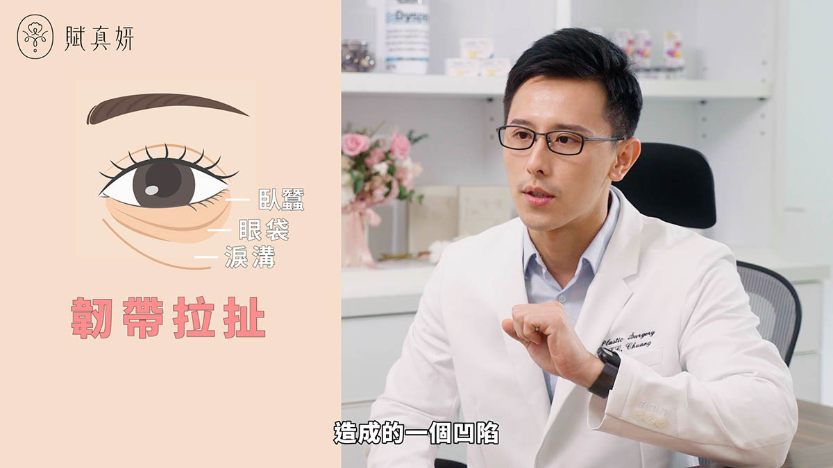 賦真妍眼袋手術 3
